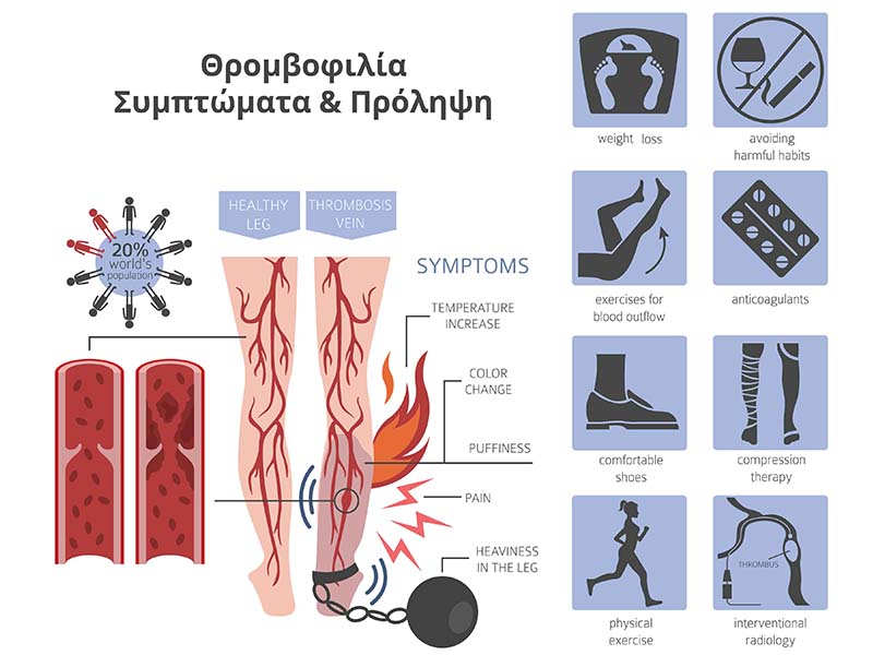 Θρομβοφιλία πρόληψη